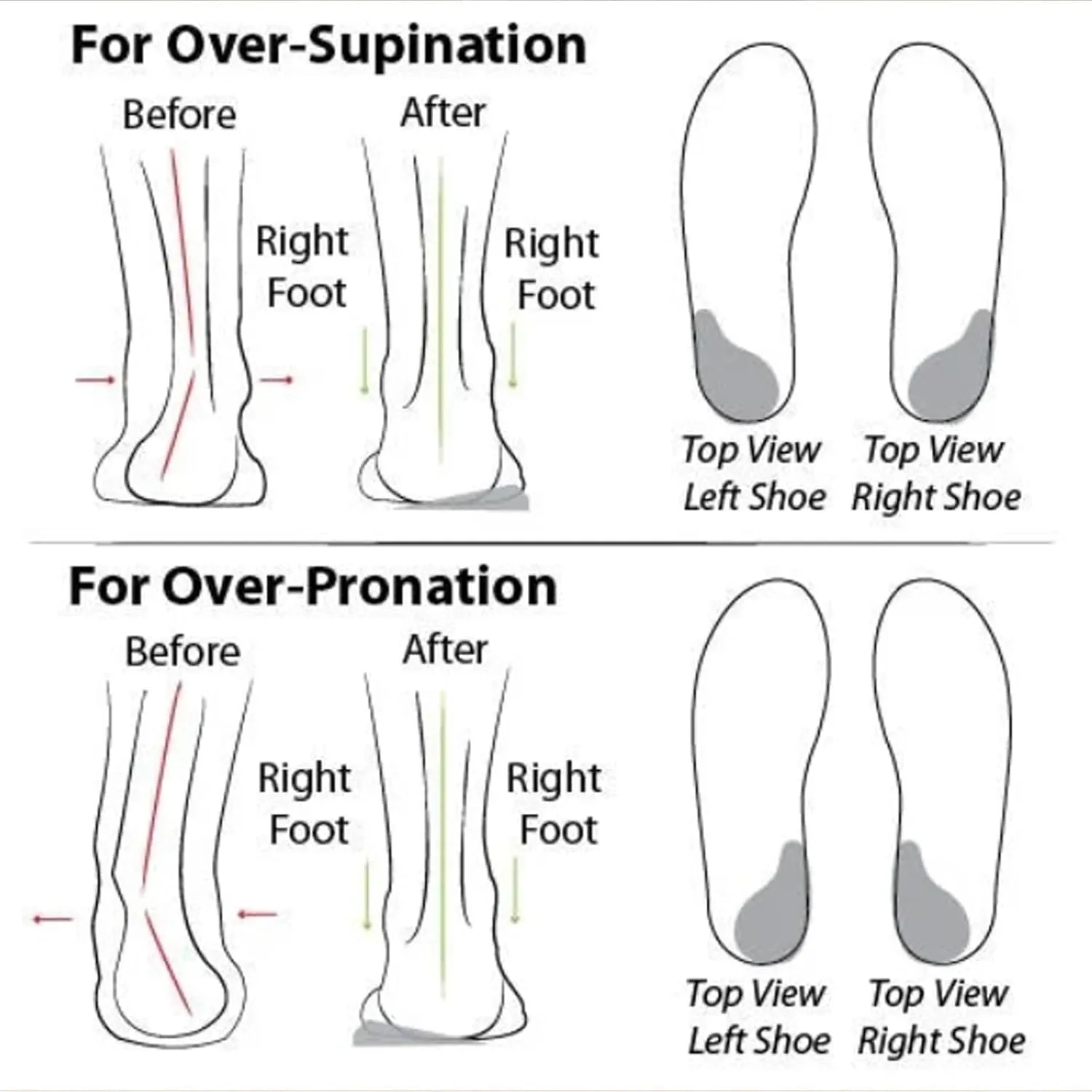 Women's Soft Sole Mesh Comfort Orthopedic Shoes, walking shoes women comfort, Orthopedic Shoes for Women, Orthopedic Walking Shoes for Women, Walking Shoes Women Comfort